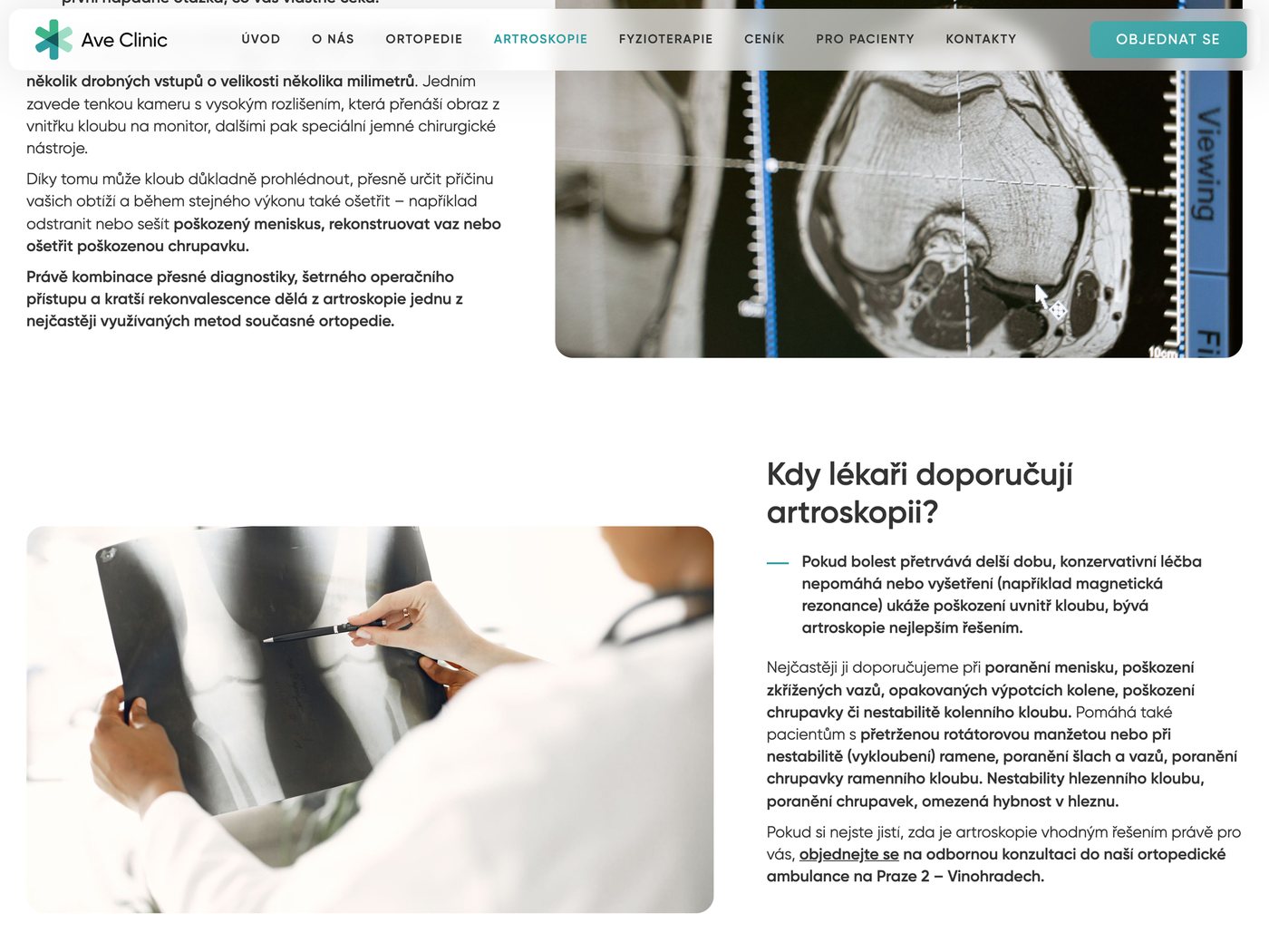 Sekce Kdy lékaři doporučují artroskopii